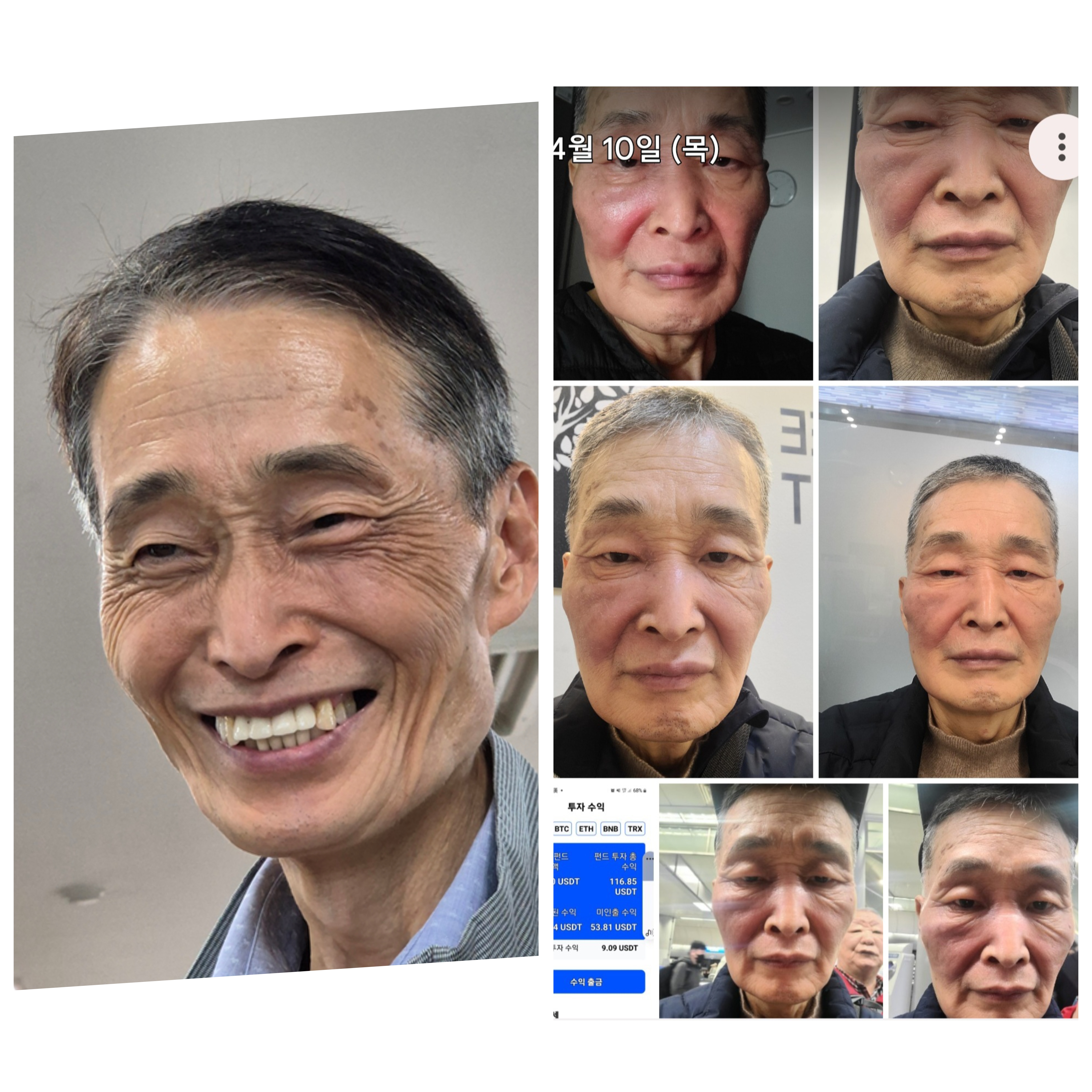 체험 사례 1