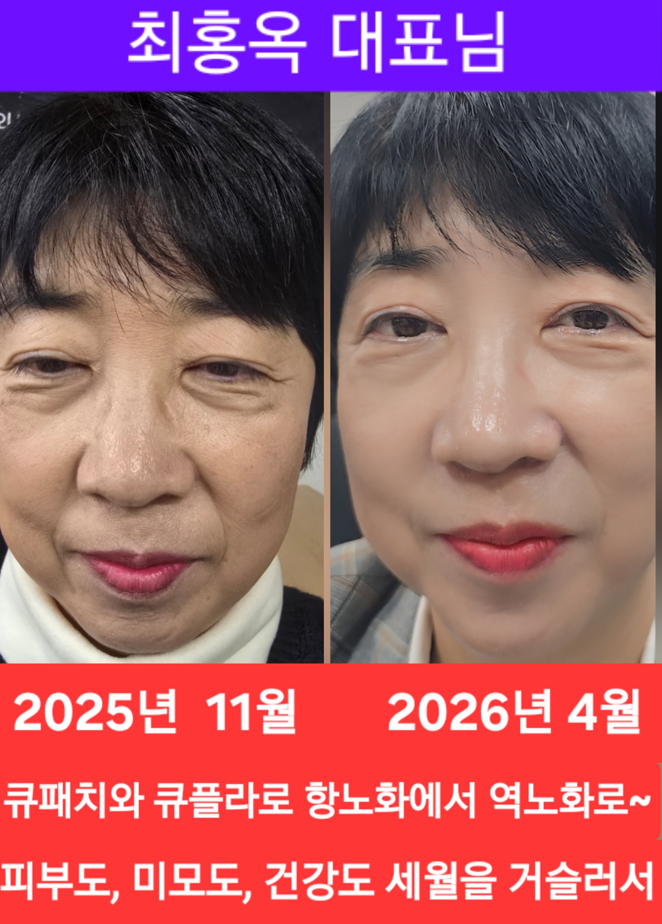 체험 사례 2